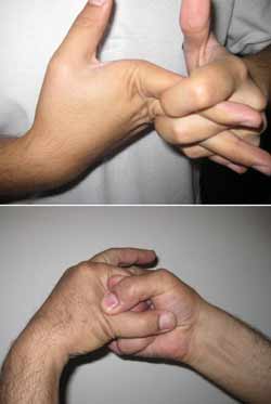 عادتی که مفصل ها را نابود می کند، ایجاد صدا از انگشتان دست و پا