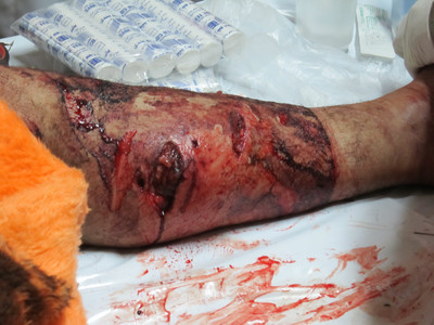 تصاویر زخمی شدن چوپان کوهرنگی در حمله خرس