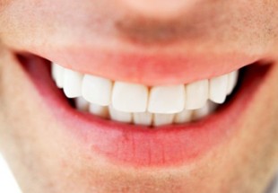 دو راه حل ساده خانگی برای سفید کردن دندان‌ها