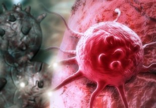 تولید ریزذراتی برای درمان نوعی سرطان در زنان