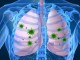 عفونت تنفسی ریسک بیماری قلبی را ۱۷ برابر افزایش می دهد