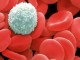 مصرف ویتامین C روند پیشرفت سرطان خون را متوقف می کند