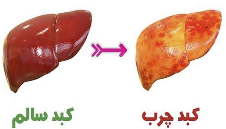 نقش حیاتی کبد برای ادامه زندگی انسان